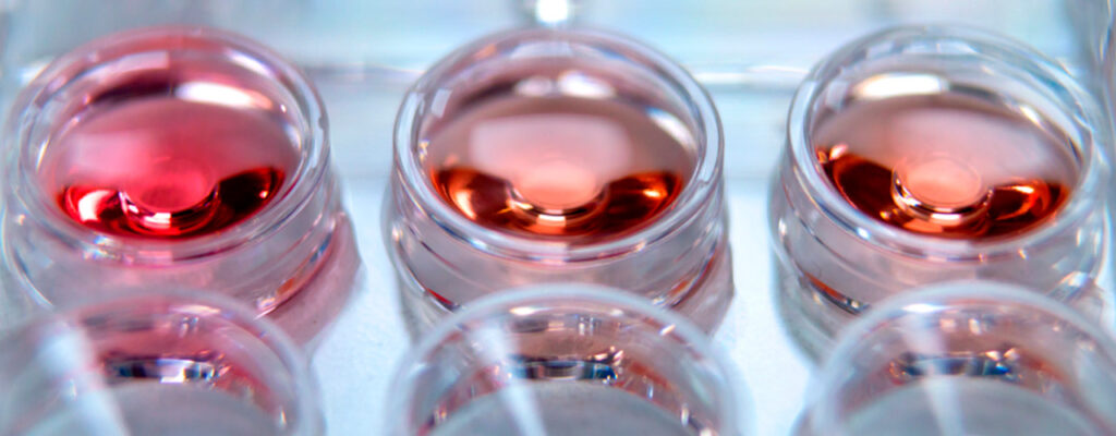 El “dual trigger” no aporta millors resultats que l’ús exclusiu de GnRH -a en preservació electiva